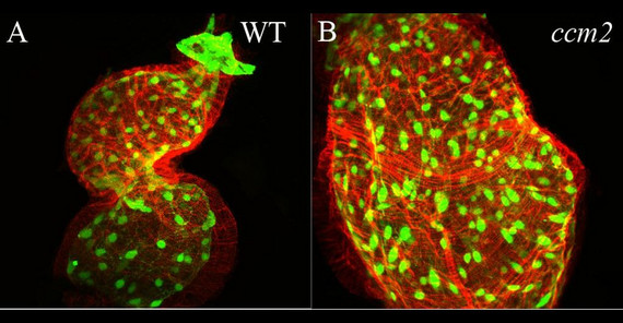 Konfokalmikroskopische Aufnahme des Herzens eines Zebrafischembryos. Der Verlust eines bestimmten Proteins führt zu einer ballonartigen Vergrößerung des Herzschlauchs (rechts). Fotos: Salim Seyfried und Marc Renz. Konfokalmikroskopische Aufnahme des Herzens eines Zebrafischembryos. Der Verlust eines bestimmten Proteins führt zu einer ballonartigen Vergrößerung des Herzschlauchs (rechts). Fotos: Salim Seyfried und Marc Renz.