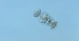 Foto einer Alge unter dem Mikroskop.