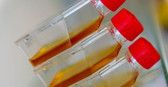 Zellkulturflasche | Foto: Tobias Hopfgarten Zellkulturflasche | Foto: Tobias Hopfgarten