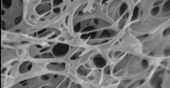 Rasterelektronenmikroskopische Aufnahme eines Polyglutaminsäure Hydrogels. Fotografie: Charlotte Vacogne (Max-Planck-Institut für Kolloid- und Grenzflächenforschung) Rasterelektronenmikroskopische Aufnahme eines Polyglutaminsäure Hydrogels. Fotografie: Charlotte Vacogne (Max-Planck-Institut für Kolloid- und Grenzflächenforschung)