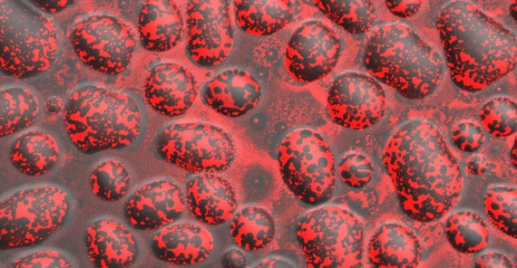 Mikroskopisch kleine Wassertropfen, die mit einer Schicht Lecithine überzogen sind. (Foto: Max-Planck-Institut für Kolloid- und Grenzflächenforschung/Roland Knorr) Mikroskopisch kleine Wassertropfen, die mit einer Schicht Lecithine überzogen sind. (Foto: Max-Planck-Institut für Kolloid- und Grenzflächenforschung/Roland Knorr)