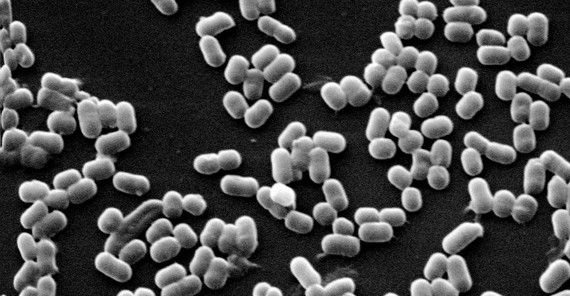 Unter dem Mikroskop offenbaren die Bakterien, die im menschlichen Darm leben, ihre Struktur. Foto: Prof. Dr. Michael Blaut. Unter dem Mikroskop offenbaren die Bakterien, die im menschlichen Darm leben, ihre Struktur. Foto: Prof. Dr. Michael Blaut.